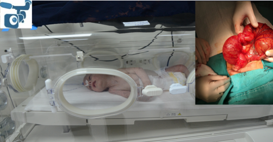 Urfa'da Yeni Doğan Bebekten Öyle Bir Şey Çıktı Ki!