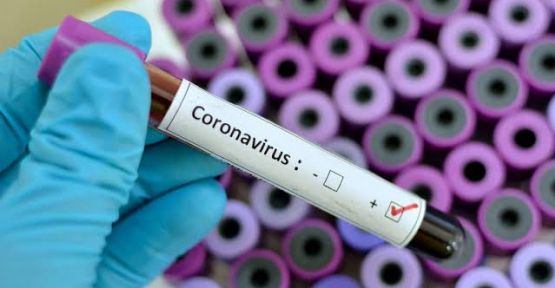 28 Temmuz koronavirüs tablosu!